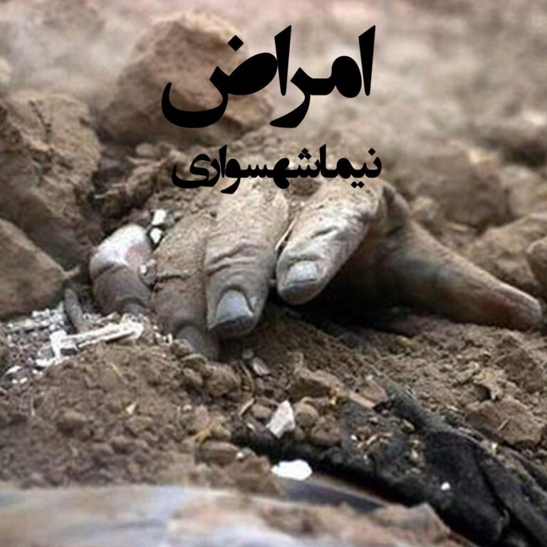 شعر صوتی امراض